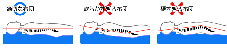 適切な寝具と不適切な寝具のイメージ