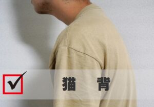 猫背
