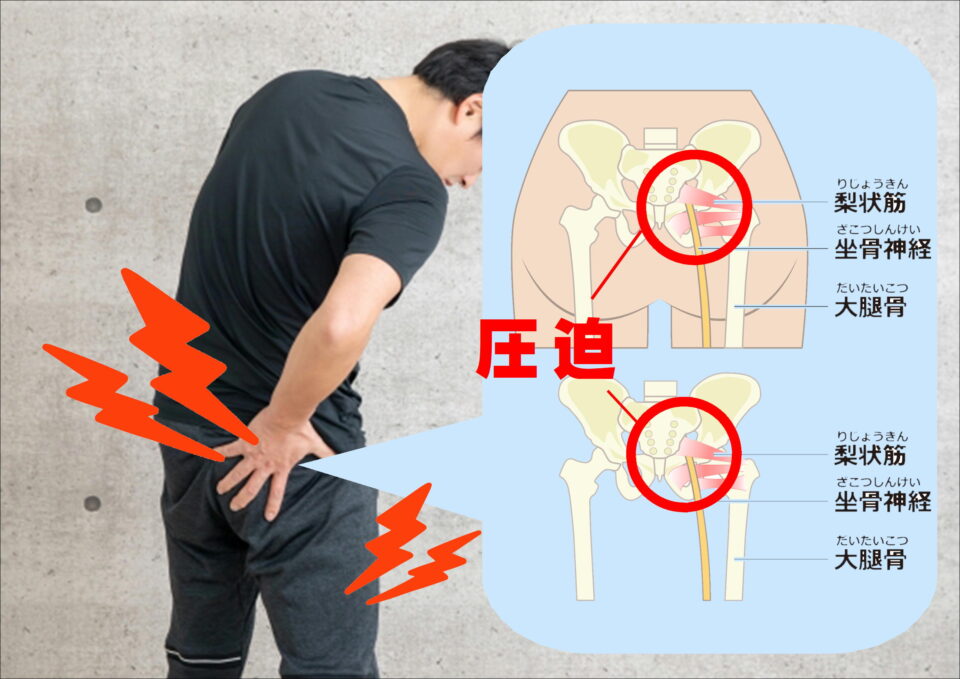 うつ病は自然に治りますか？