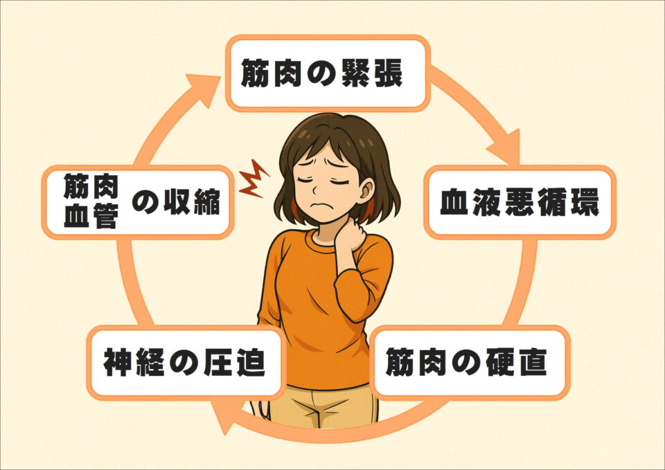 肩こりが悪化するメカニズムを表した図。筋肉の緊張から血流悪化、神経圧迫までの悪循環が循環的に示されている。